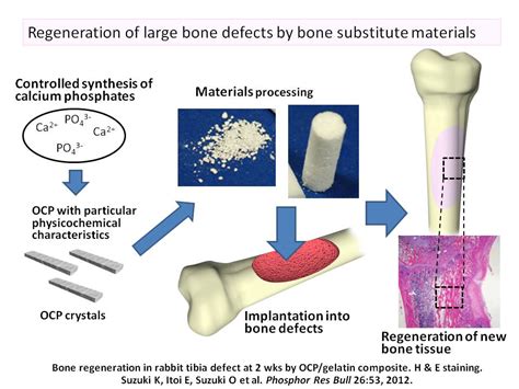  Osteoconductioneel Ossine: Hoe een Synthetisch Materiaal Botgenezing Versnelt!